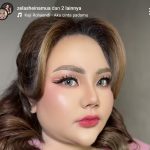 Perjalanan Lisa Mariana Usai Jalani Bariatrik di Malaysia Terancam Gagal?